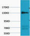 Nitric Oxide Synthase 3 antibody, M01604, Boster Biological Technology, Western Blot image 