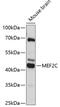 Myocyte Enhancer Factor 2C antibody, 14-391, ProSci, Western Blot image 