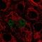 Transcription Factor EC antibody, NBP2-57258, Novus Biologicals, Immunofluorescence image 