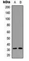 Ribosomal Protein S6 antibody, GTX54985, GeneTex, Western Blot image 