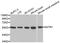 Somatostatin Receptor 1 antibody, STJ25705, St John