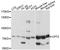 CPT2 antibody, A12426, ABclonal Technology, Western Blot image 