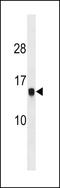 Histone Cluster 1 H2A Family Member M antibody, LS-C159837, Lifespan Biosciences, Western Blot image 