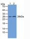 Glutathione S-Transferase Mu 1 antibody, LS-C294266, Lifespan Biosciences, Western Blot image 