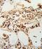 TIMP Metallopeptidase Inhibitor 3 antibody, PA5-26133, Invitrogen Antibodies, Immunohistochemistry frozen image 
