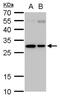 Sad1 And UNC84 Domain Containing 1 antibody, PA5-78443, Invitrogen Antibodies, Western Blot image 