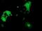 Dystrobrevin Alpha antibody, NBP2-03422, Novus Biologicals, Immunocytochemistry image 