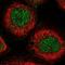 Potassium Voltage-Gated Channel Subfamily A Member Regulatory Beta Subunit 1 antibody, NBP1-90194, Novus Biologicals, Immunocytochemistry image 
