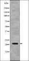 p21 antibody, orb336159, Biorbyt, Western Blot image 