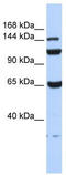 EF-Hand Calcium Binding Domain 13 antibody, TA338825, Origene, Western Blot image 
