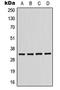 p58 NK receptor CL-43 antibody, LS-C352420, Lifespan Biosciences, Western Blot image 