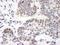 Zinc Finger MYM-Type Containing 3 antibody, NB100-458, Novus Biologicals, Immunohistochemistry paraffin image 