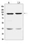 Dihydropyrimidine Dehydrogenase antibody, A01749, Boster Biological Technology, Western Blot image 