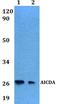 Activation Induced Cytidine Deaminase antibody, GTX66778, GeneTex, Western Blot image 