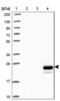 Apolipoprotein M antibody, NBP2-48991, Novus Biologicals, Western Blot image 