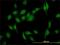 Vesicle-trafficking protein SEC22b antibody, H00009554-M01, Novus Biologicals, Immunofluorescence image 