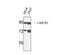 ATP Binding Cassette Subfamily B Member 5 antibody, GTX34025, GeneTex, Western Blot image 