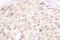 Cyclin Dependent Kinase Inhibitor 2C antibody, LS-C176156, Lifespan Biosciences, Immunohistochemistry paraffin image 