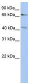 Carbohydrate Sulfotransferase 13 antibody, TA330983, Origene, Western Blot image 