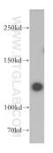 Protein Phosphatase 6 Regulatory Subunit 1 antibody, 17819-1-AP, Proteintech Group, Western Blot image 