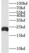 Tumor necrosis factor alpha-induced protein 8 antibody, FNab08819, FineTest, Western Blot image 