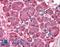 SKI Proto-Oncogene antibody, LS-B552, Lifespan Biosciences, Immunohistochemistry paraffin image 