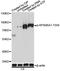 Ribosomal Protein S6 Kinase A1 antibody, LS-C750576, Lifespan Biosciences, Western Blot image 