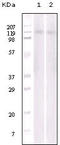 EPH Receptor B6 antibody, M04270, Boster Biological Technology, Western Blot image 