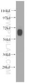 Gamma-Aminobutyric Acid Type A Receptor Delta Subunit antibody, 15623-1-AP, Proteintech Group, Western Blot image 