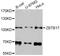 Zinc Finger And BTB Domain Containing 17 antibody, A8463, ABclonal Technology, Western Blot image 