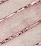 Sarcoglycan Delta antibody, orb125144, Biorbyt, Immunohistochemistry paraffin image 