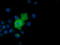 Adenylate Kinase 5 antibody, LS-C115597, Lifespan Biosciences, Immunofluorescence image 