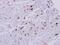 Major Histocompatibility Complex, Class II, DR Alpha antibody, NBP1-31512, Novus Biologicals, Immunohistochemistry frozen image 