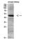 Lysosomal Associated Membrane Protein 3 antibody, A09406, Boster Biological Technology, Western Blot image 