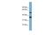 ADAM Like Decysin 1 antibody, GTX45338, GeneTex, Western Blot image 