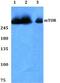Mechanistic Target Of Rapamycin Kinase antibody, A00003S2442, Boster Biological Technology, Western Blot image 