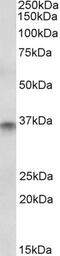 Caudal Type Homeobox 2 antibody, PA5-18492, Invitrogen Antibodies, Western Blot image 