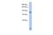 Phosphodiesterase 6A antibody, A07800, Boster Biological Technology, Western Blot image 