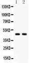 Serpin Family H Member 1 antibody, LS-C357514, Lifespan Biosciences, Western Blot image 