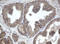 Palmitoyl-Protein Thioesterase 1 antibody, LS-C175330, Lifespan Biosciences, Immunohistochemistry paraffin image 