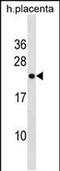 Ring Finger Protein 122 antibody, PA5-49075, Invitrogen Antibodies, Western Blot image 