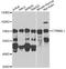 Beta-catenin-like protein 1 antibody, STJ28655, St John