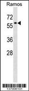 Prolyl 4-Hydroxylase Subunit Alpha 1 antibody, MBS9209736, MyBioSource, Western Blot image 