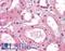 GM2 Ganglioside Activator antibody, LS-A8933, Lifespan Biosciences, Immunohistochemistry paraffin image 