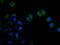 Interferon Induced Protein With Tetratricopeptide Repeats 1 antibody, CSB-PA011018LA01HU, Cusabio, Immunofluorescence image 