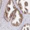 CD47 Molecule antibody, NBP2-32031, Novus Biologicals, Immunohistochemistry frozen image 