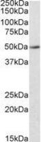 Indoleamine 2,3-Dioxygenase 2 antibody, GTX88374, GeneTex, Western Blot image 