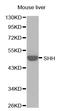 Sonic Hedgehog Signaling Molecule antibody, STJ25524, St John