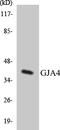 Gap Junction Protein Alpha 4 antibody, LS-C291991, Lifespan Biosciences, Western Blot image 