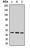 Cholinergic Receptor Nicotinic Epsilon Subunit antibody, orb411657, Biorbyt, Western Blot image 
